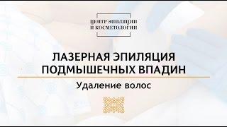 Лазерная эпиляция подмышек. Центр эпиляции и косметологии Казань