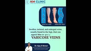 VARICOSE VEINS || vascular surgery #shorts