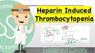 Heparin Induced Thrombocytopenia Basics - Pathology, Diagnosis, 4T Score, Manage | Clinical Medicine