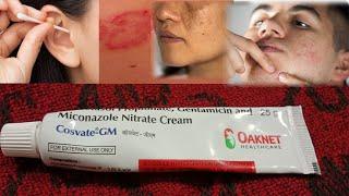 COSVATE - GM CREAM | How To Use  Cosvate gm cream  | क्रीम के फायदे और नुकसान | Skin Allergy Cream