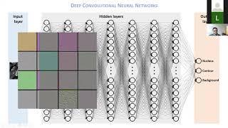 Thierry Pecot - Deep learning to segment nuclei with only 3 annotated images - Imaging ONEWORLD