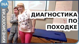 Диагностика болезни по походке. Миофасциальные цепи. Прикладная кинезиология Васильева Л.Ф.