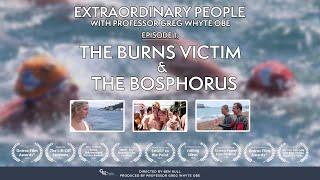 Extraordinary People - The Burns Victim and the Bosphorus (Award-winning documentary)