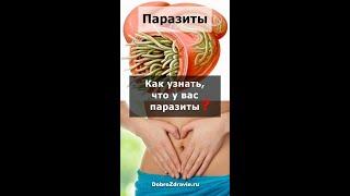 7 признаков ПАРАЗИТОВ. Как узнать, что у вас глисты в организме – симптомы заражения гельминтами