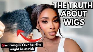  “WARNING: Wigs Are Destroying Hairlines & No One Is Talking About It! Is too late to save yours?