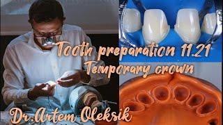 A lesson in the preparation of teeth for crowns. Temporary crowns. Dr. Artem Oleksik.