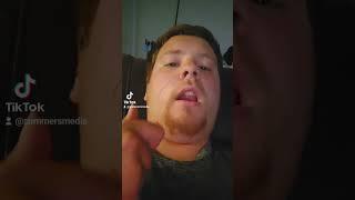 summersmedia tiktok pulls nose hair on video and blood goes every where oh my goodness must watch