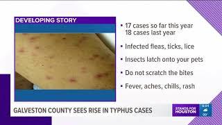 Galveston County sees rise in typhus cases