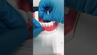 ¿Cómo usar hilo dental correctamente?