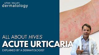 Why Do Hives Happen?? | Utah Valley Dermatology