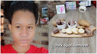 Remove Dark Spots In Just 1 Week || 100% Works || Clear Uneven Skin
