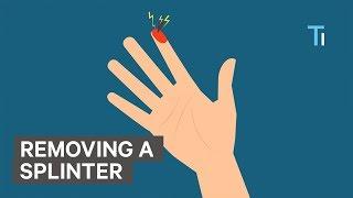 How To Remove A Splinter