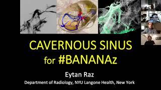 2020 05 05 BANANAZ Cavernous Sinus