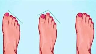 Do You Have Longer Toe? Beware with the Greek Foot!!