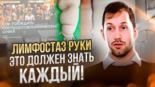 ЛИМФОСТАЗ РУКИ - это должен знать каждый!