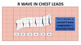 Normal R wave progression, NORMAL R WAVE IN LIMB AND CHEST LEADS  "NORMAL ECG VALUES" | NARCOSIS