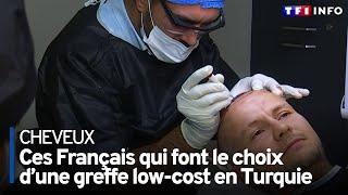 Enquête sur le marché des implants capillaires en Turquie