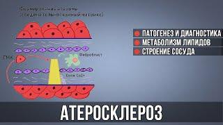 АТЕРОСКЛЕРОЗ │ Патогенез, диагностика, лечение и профилактика