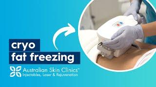 CryoDefine Fat Freezing | Australian Skin Clinics