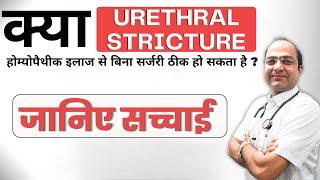 क्या Urethral Stricture होम्योपैथिक इलाज से ठीक हो सकता है ? जानिए सच्चाई | Dr. Rawat Choudhary