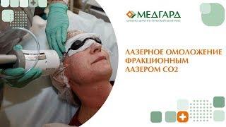 Процедура лазерного омоложения в Клинике Медгард-Саратов.