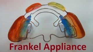 Role of Frankel Appliances by Prof John Mew