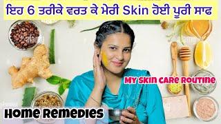 Like Pigmentation, blemishe ਗਰਮੀਆਂ ਵਿੱਚ ਇਹ ਤਰੀਕੇ ਵਰਤ ਕੇ ਤੁਸੀ ਕਰ ਸਕਦੇ ਹੋ ਆਪਣੀ Skin ਪੂਰੀ ਸਾਫ #rg786