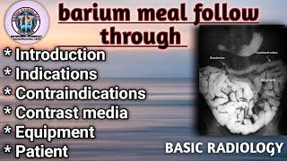 barium meal follow through // BMFT complete procedure #radio #procédure