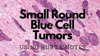 Small Round Blue Cell Tumor Ddx: Using Kurt’s Notes #pathagonia