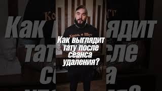 Как исчезает тату? Этапы лазерного удаления #shorts