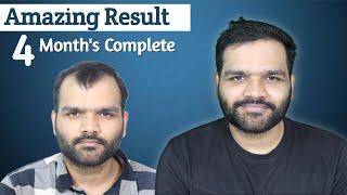 Hair Transplant in Bhopal | Cost of Hair Transplant in Bhopal | Hair Transplant Doctor in Bhopal