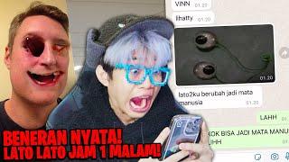 Mata Anak ini Copot Akibat Kena Lato-Lato Tempat Jam 01:08 Malam!!!