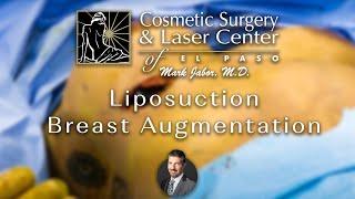 Liposuction + Breast Augmentation- Cosmetic Surgery and Laser Center of El Paso | Dr. Mark Jabor
