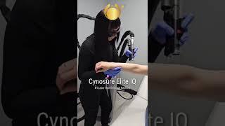 Laser hair removal w Cynosure Elite IQ
