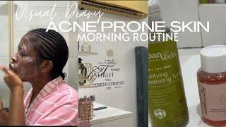 Morning Routine: Acne Prone Skin | Omotola Igbenoba