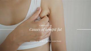 Causes of armpit fat | Amaris B. Clinic by Dr Ivan Puah