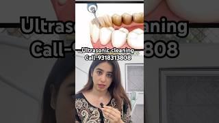 Ultrasonic teeth cleaning #bestdentistindelhi #whiteteeth #smilemakeover #bestdentalclinicnearme