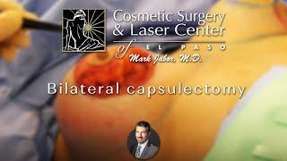 Bilateral Capsulectomy - Cosmetic Surgery & Laser Center of El Paso