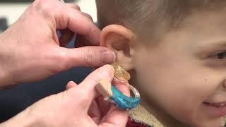 How To Insert An Earmold And Hearing Aid In A Child's Ear