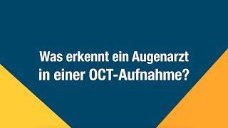 Was ist eine OCT-Aufnahme?