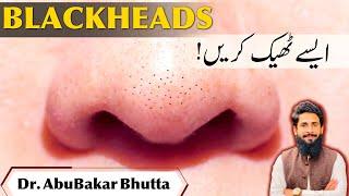 #8 Easy TIPS to remove BLACKHEADS | Home Remedies | Dr AbuBakar Bhutta