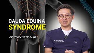 MEMAHAMI CAUDA EQUINA️ | DR TONY SETIOBUDI