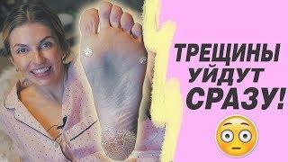 ТРЕЩИНЫ НА ПЯТКАХ УЙДУТ СРАЗУ! Бюджетное средство от натоптышей и мозолей. Уход за пятками дома