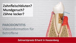 Parodontitis-Behandlung Zahnarzt Hauzenberg - Dres. Erhard