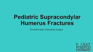 Supracondylar Humerus Fractures