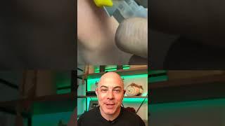 Doctor reacts to extremely satisfying and RIDICULOUS splinter removal! #dermreacts #doctorreacts