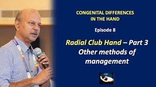 Congenital hand differences: Episode 8 - Other methods of treatment for Radial Club hand