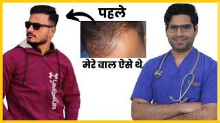 Hair Transplant In India - Hair Transplant Result And Complete Journey | AwishClinic.com