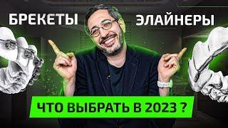 Брекеты или Элайнеры — что лучше в 2023 году? Плюсы и Минусы