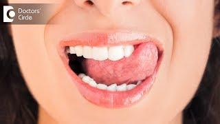 Causes & management for loss of tooth enamel - Dr. Aarthi Shankar